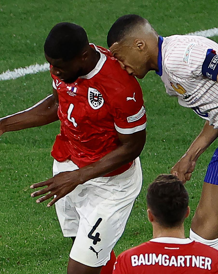 Килиан Мбаппе сломал нос в первой же игре чемпионата Европы