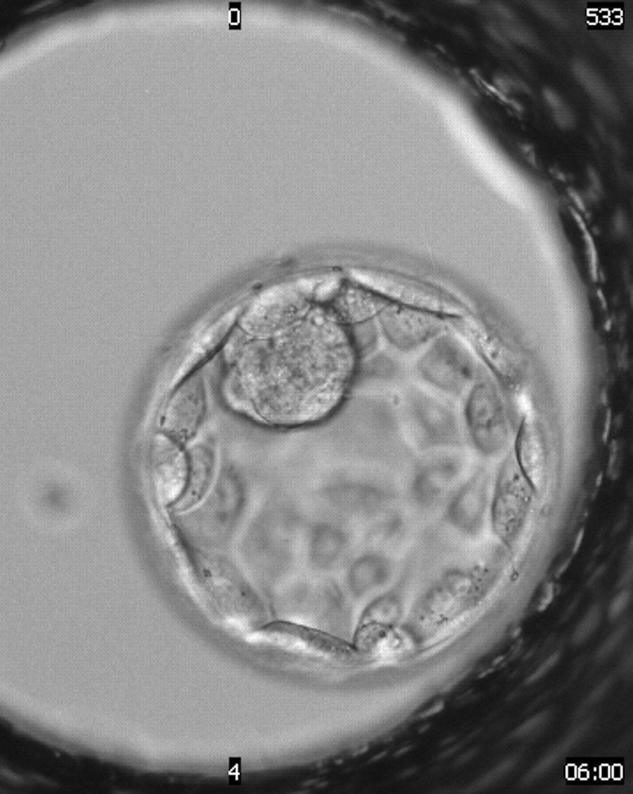 Студенты Сеченовского университета создали уникальную систему анализа эмбрионов для ЭКО