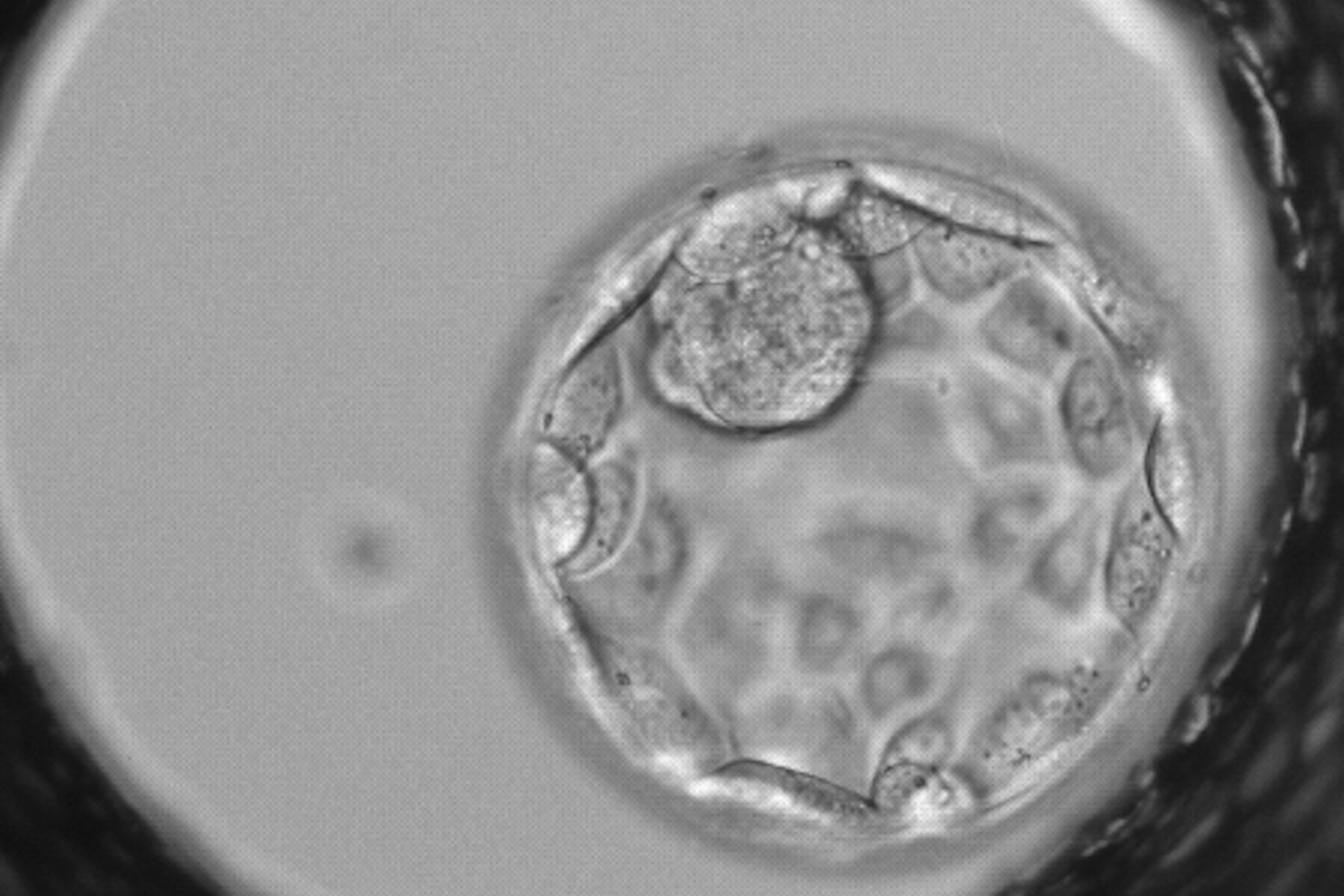 Студенты Сеченовского университета создали уникальную систему анализа эмбрионов для ЭКО