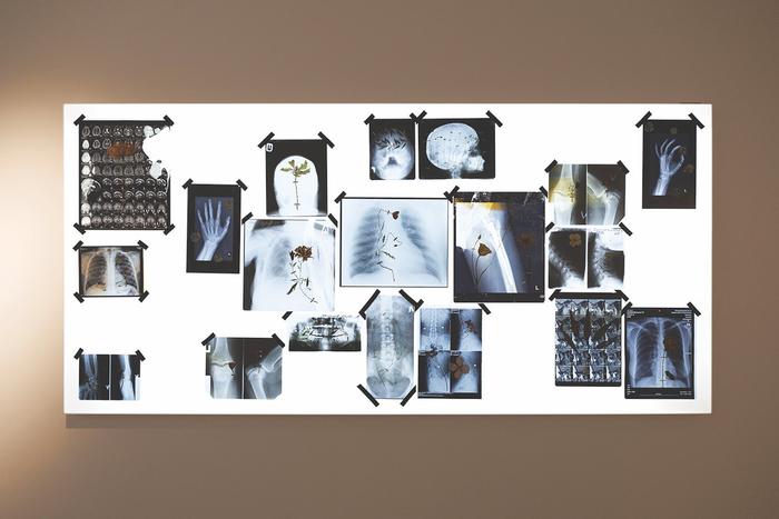 Художница украсила цветами настоящие рентгеновские снимки. Так она решили порассуждать о человеческой хрупкости и уязвимости