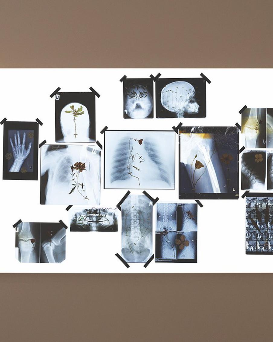 Художница украсила цветами настоящие рентгеновские снимки. Так она решили порассуждать о человеческой хрупкости и уязвимости