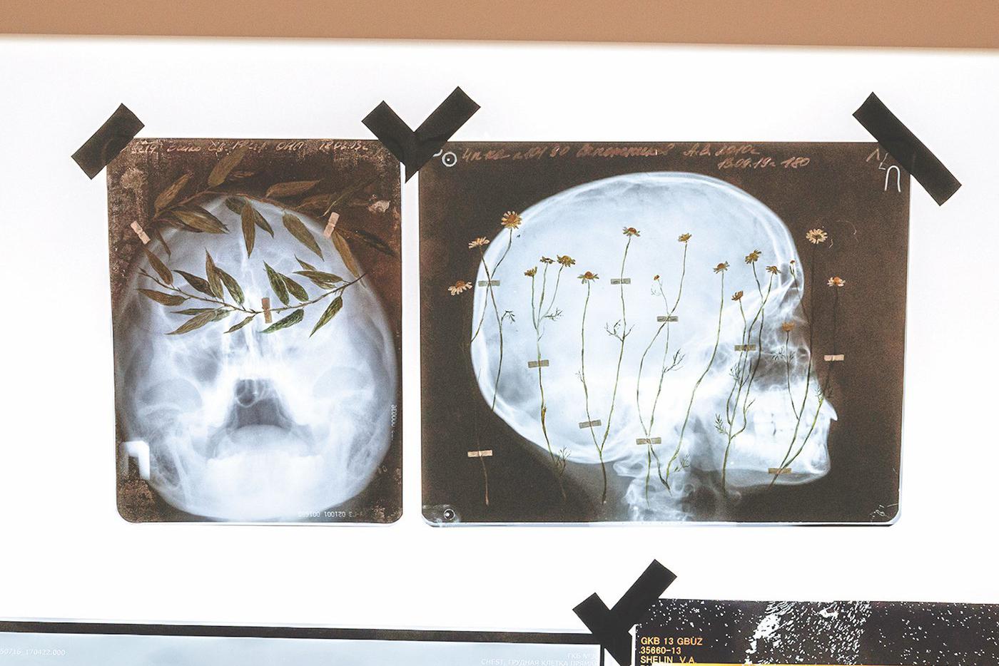 Художница надеется, что кто-то оценит деликатность цветов, как они действительно похожи на настоящие высушенные и вклеенные гербарии, а кто-то удивится рентгенам и вспомнит о быстротечности времени