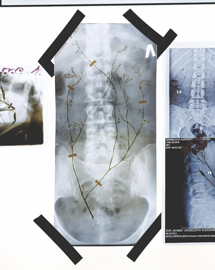 Некоторые из абстрактных работ художницы были похожи на рентгены, так она и пришла к этой идее