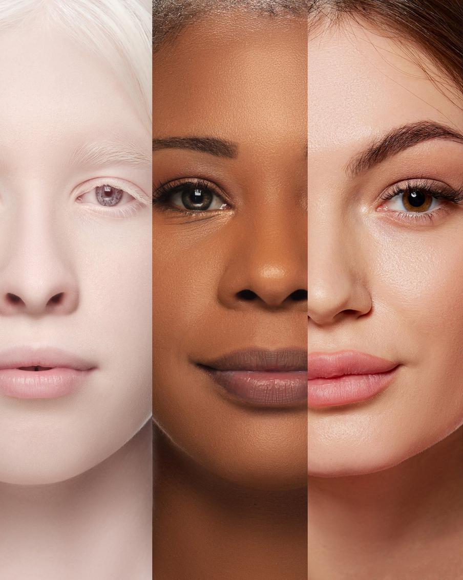 Всё о фототипах кожи: гайд от дерматолога