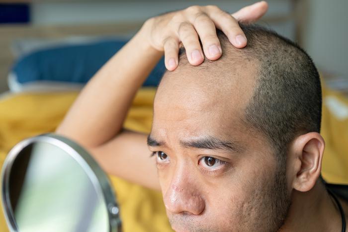 По волосам теперь не плачут: сладкое лекарство восстановит шевелюру