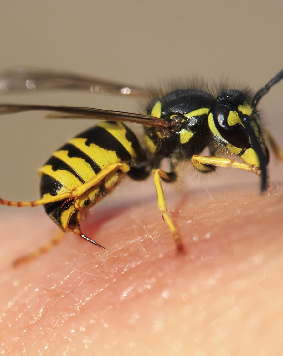 Молдавского депутата не смогли спасти после укусов ос