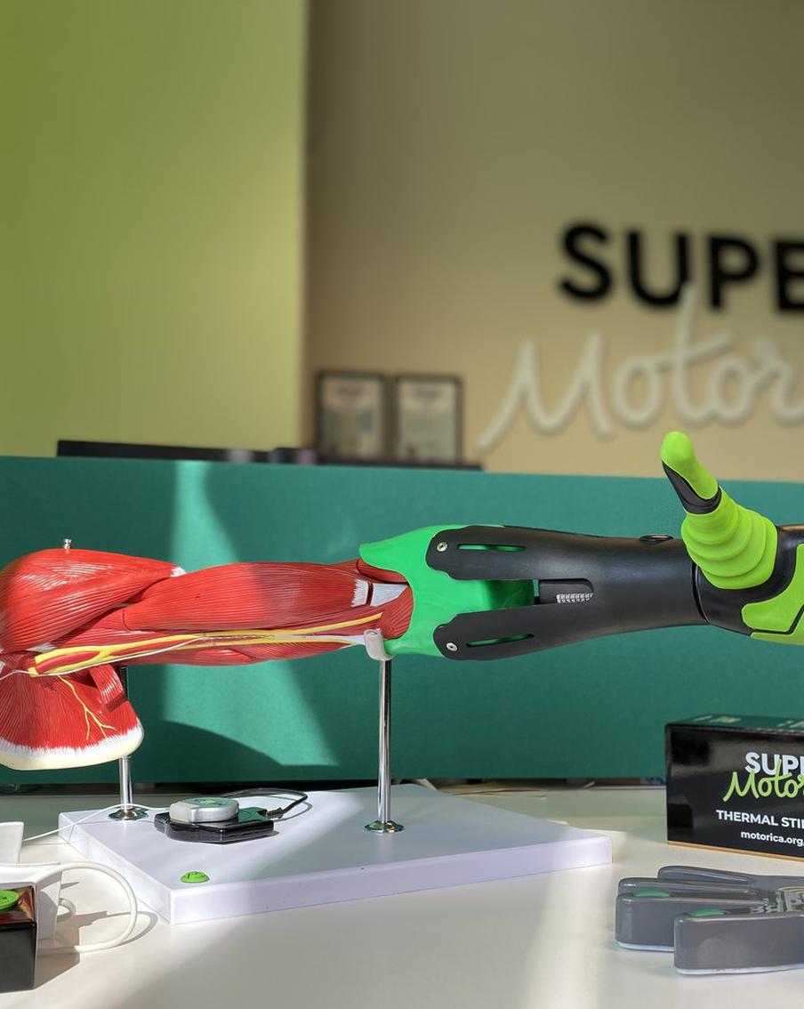 Инновационный протез руки поможет почувствовать тепло и холод