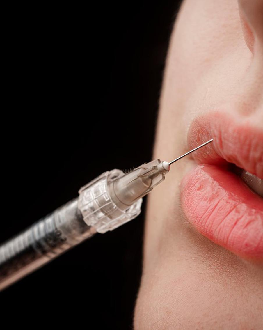 О каких нюансах стоит помнить, если вы решитесь сделать губы больше