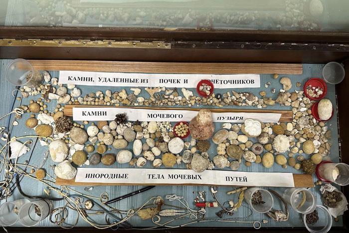 Врач-уролог из Балашихи собирает совсем не драгоценные камни