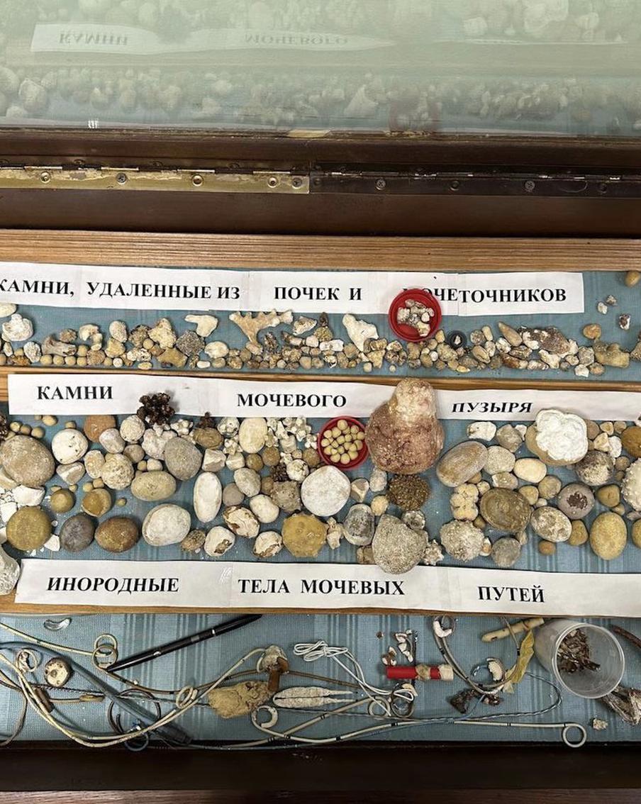 Врач-уролог из Балашихи собирает совсем не драгоценные камни