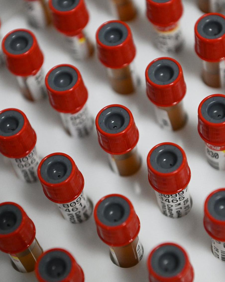 Учёным впервые удалось успешно вырастить стволовые клетки крови в лаборатории