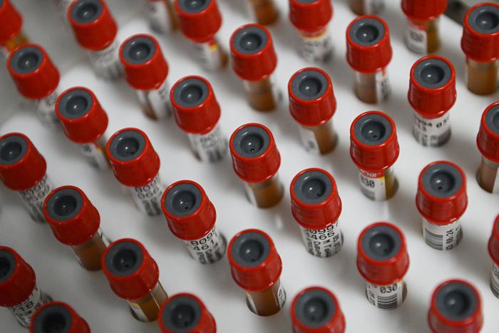 Учёным впервые удалось успешно вырастить стволовые клетки крови в лаборатории