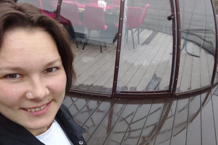 Жертве подражателя мужа Грачёвой собирают деньги на косметический протез