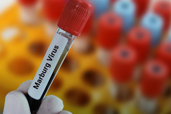 Миру угрожает новая эпидемия: смертельный вирус Марбурга, вызывающий сильные кровотечения