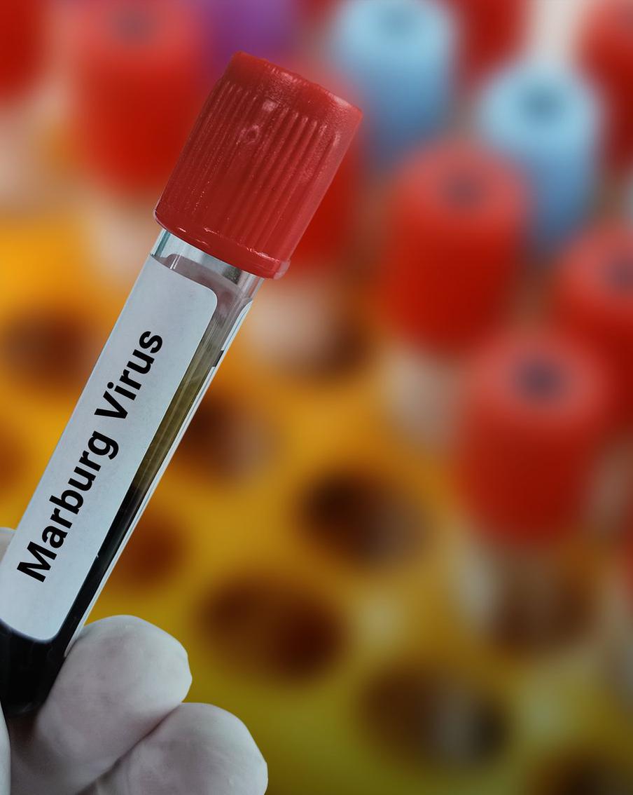 Миру угрожает новая эпидемия: смертельный вирус Марбурга, вызывающий сильные кровотечения
