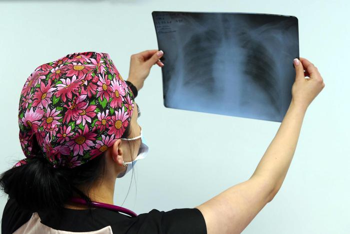 В России зафиксировали рост заболеваемости пневмониями