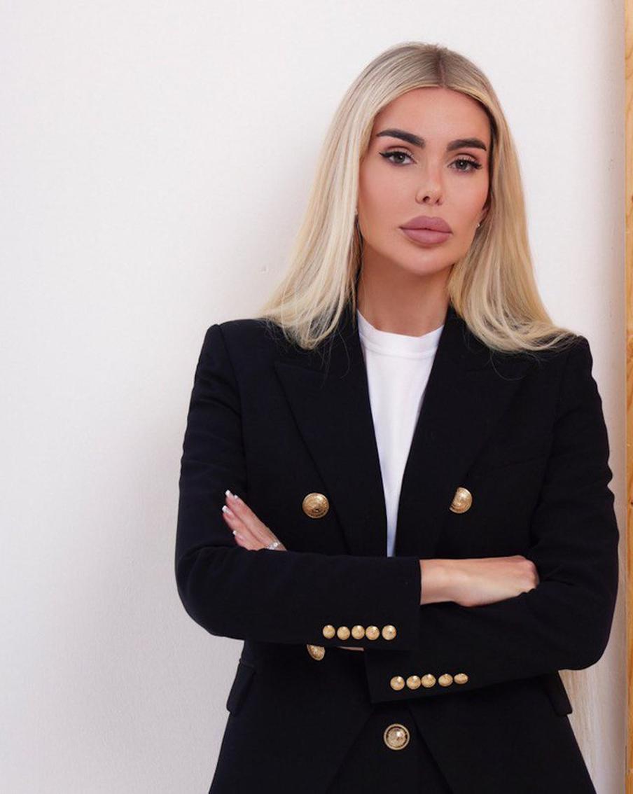 Алиса Лобанова отметила важность женской солидарности во время развода