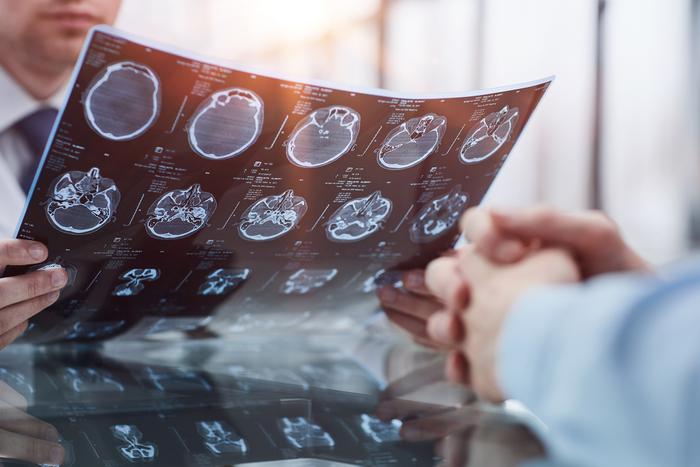 Восстановить мозг поможет новый датчик: его разработают в России через год