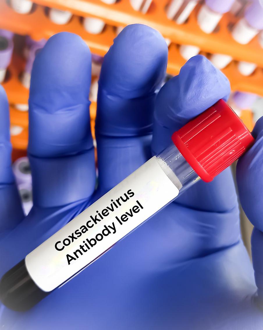 Россиян отговаривают от отдыха в Турции из-за вируса, от которого "пухнут мозги"