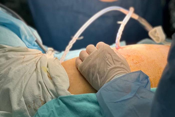 Московские врачи стали применять эффективную методику лечения рака