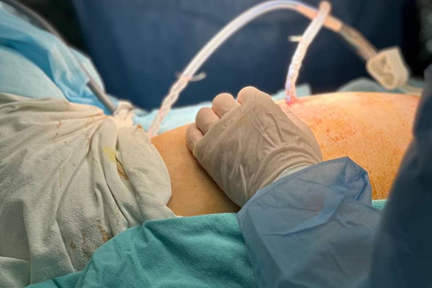 Московские врачи стали применять эффективную методику лечения рака