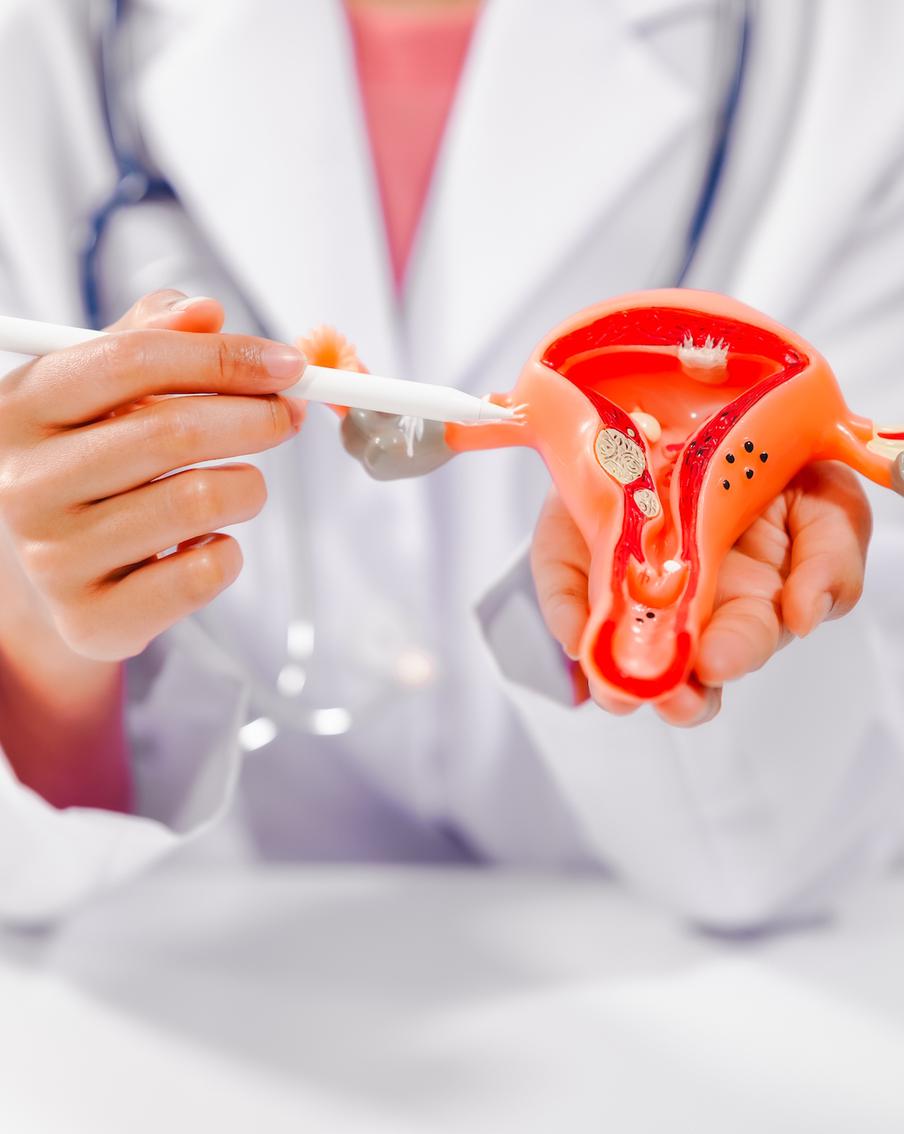 От Вупи Голдберг до Джейми Кинг: как стать матерью при эндометриозе