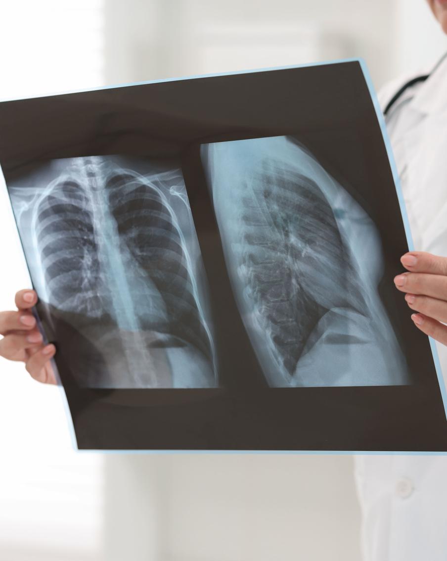 В Роспотребнадзоре опровергли информацию о росте заболеваемости микоплазменной пневмонией в России