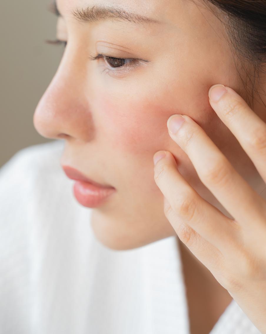 Подбираем уход за чувствительной кожей с куперозом: топ-5 советов от эксперта