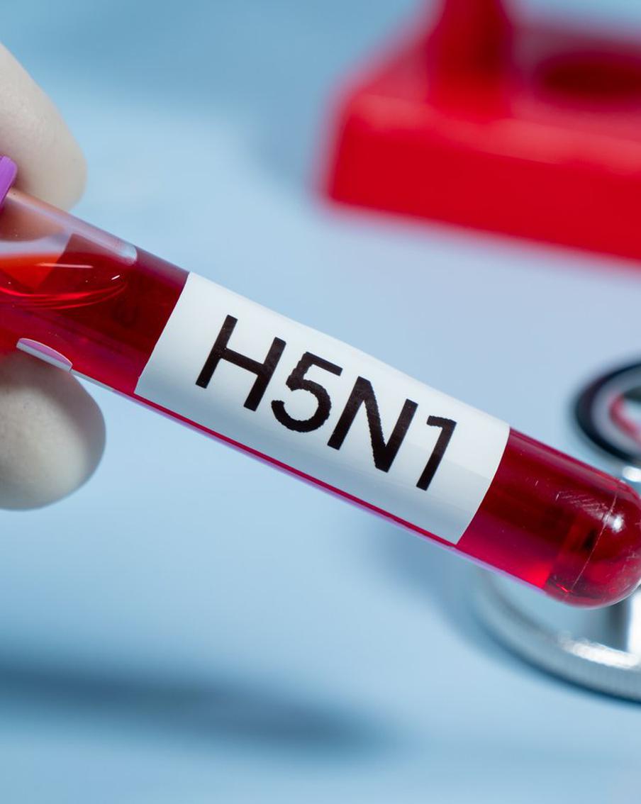 Первый пациент с птичьим гриппом скончался в США