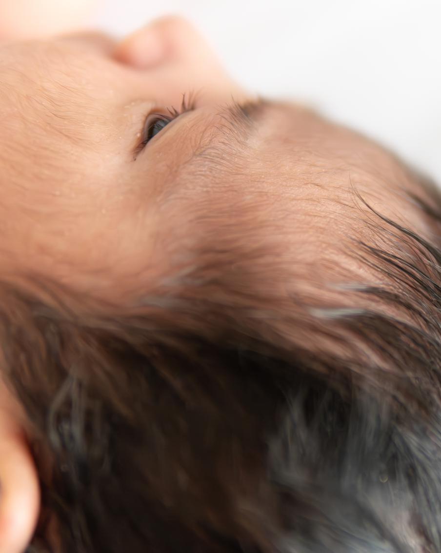 Испанские дети с "cиндромом оборотня" шокировали Европу