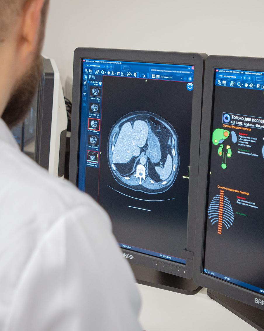Как искусственный интеллект помогает московским врачам ставить точные диагнозы