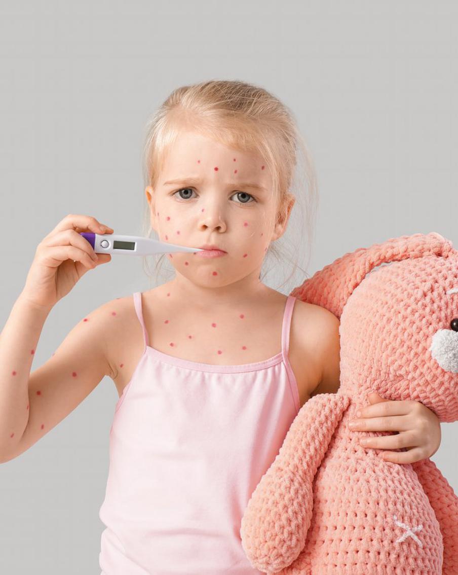 Вести своего ребёнка на "ветряночную вечеринку" – не лучшая идея