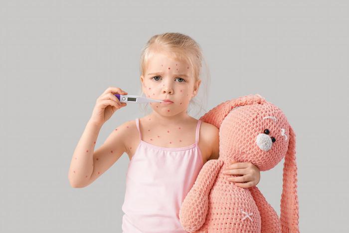 Вести своего ребёнка на "ветряночную вечеринку" – не лучшая идея