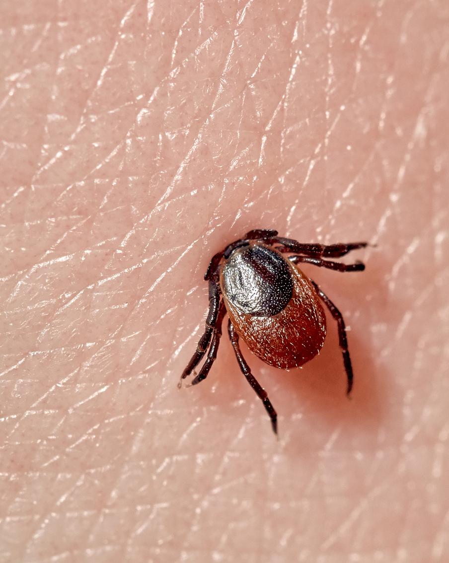 В Подмосковье зафиксировали первый случай укуса клеща в этом году