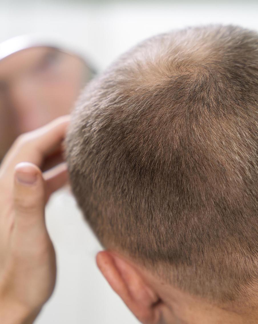 Волосы могут выпадать по разным причинам. Но правильное питание поможет им в любом случае