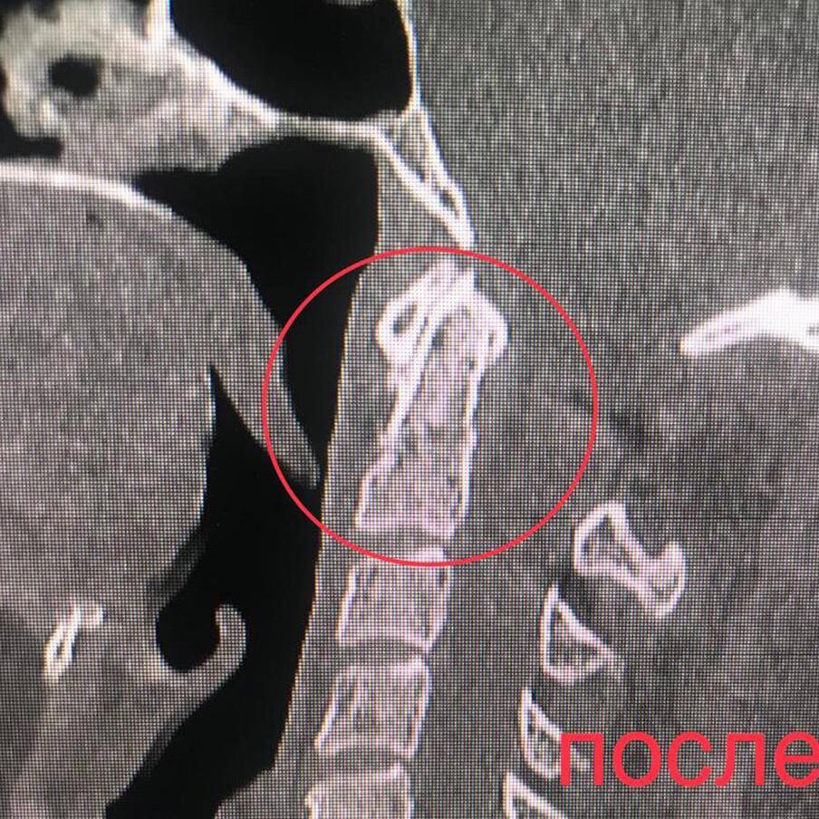 Так выглядели снимки пациента до операции и после.