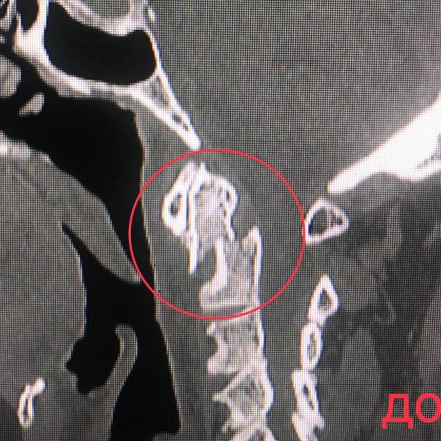 Так выглядели снимки пациента до операции и после.