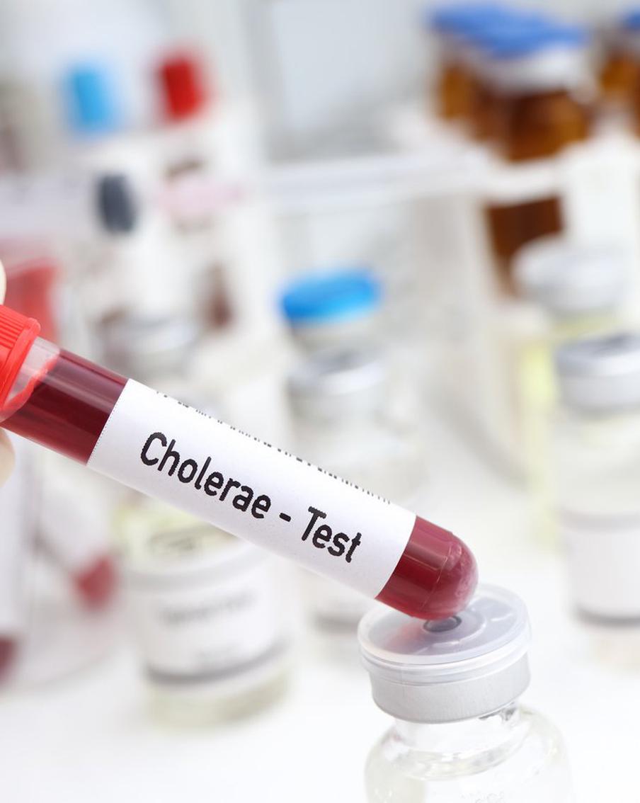 Как проявляется холера, которую за последний месяц диагностировали в Москве два раза