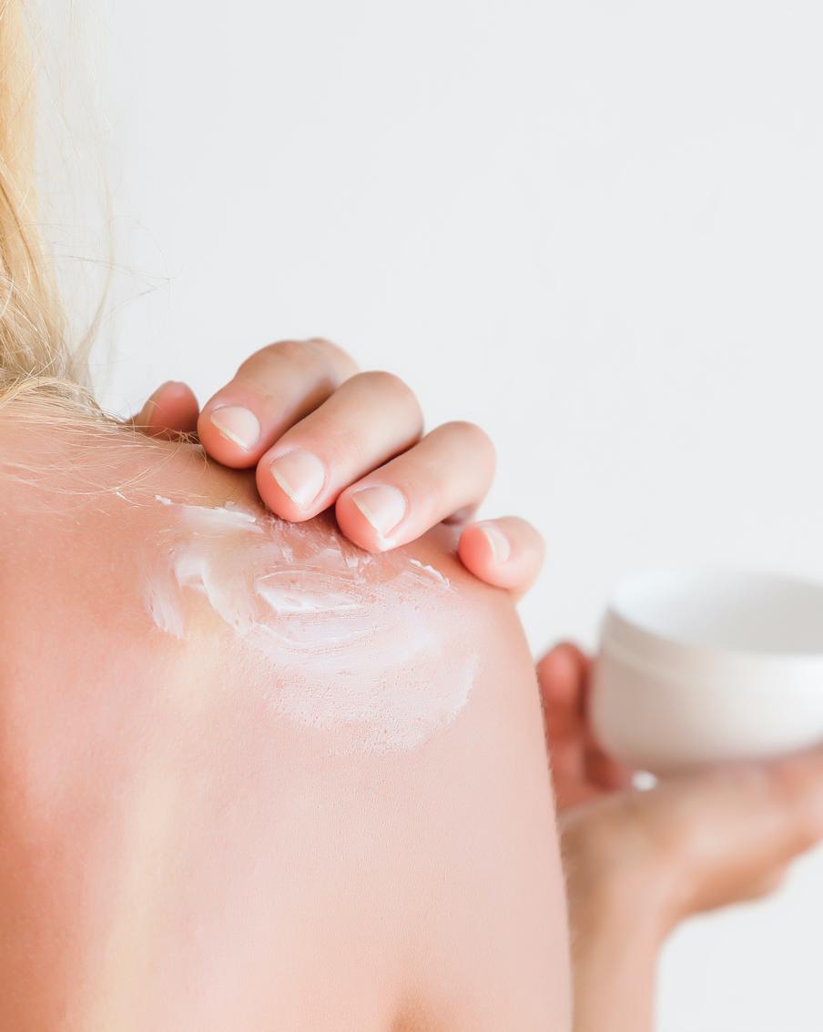 Обгорели на солнце? Разбираемся, что поможет коже, а что только ухудшит ожог