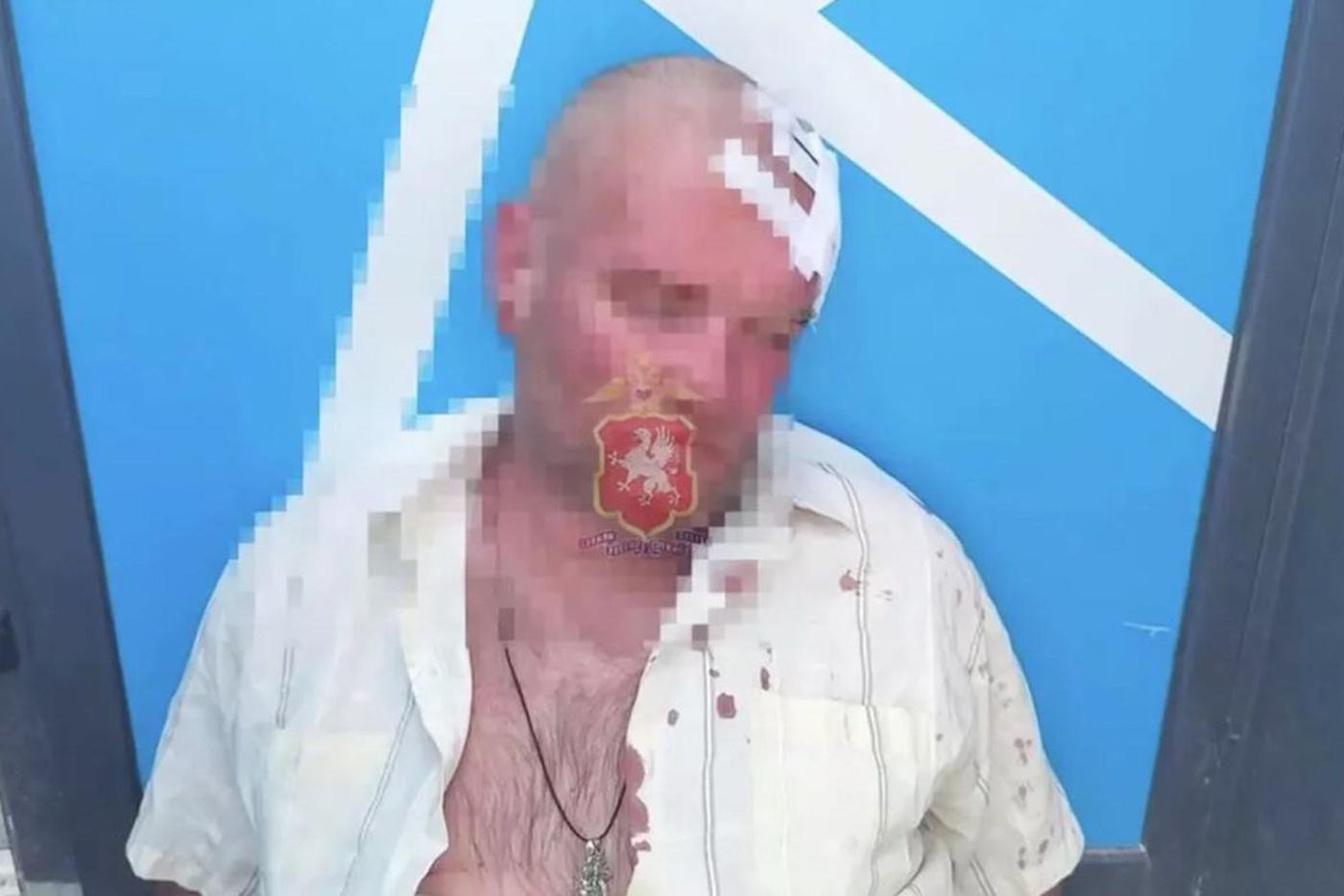 В Севастополе задержан мужчина, напавший на бывшую тёщу