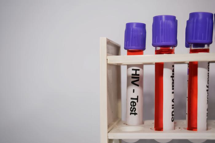 В Подмосковье за три года снизилась заболеваемость ВИЧ на 10,6%