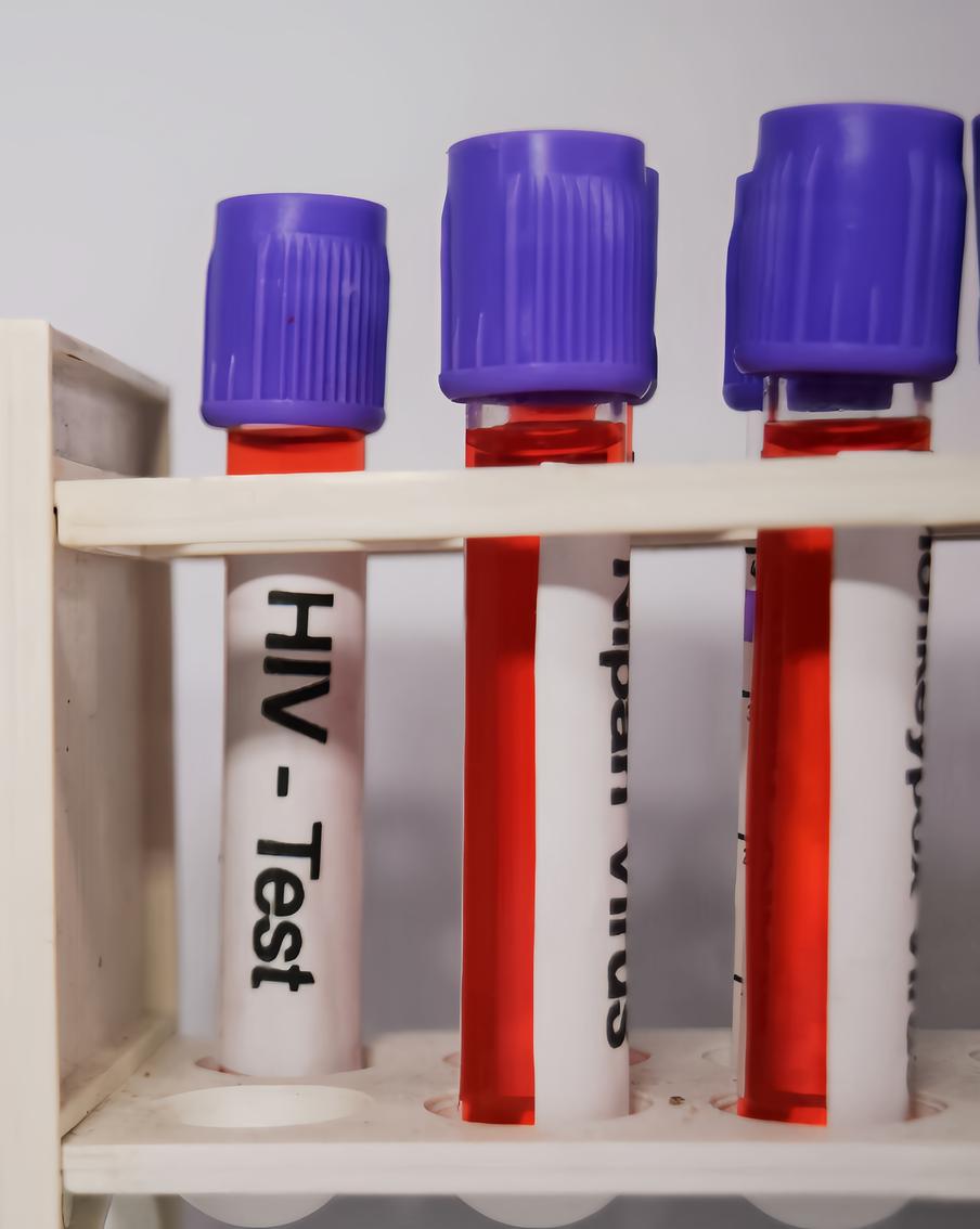 В Подмосковье за три года снизилась заболеваемость ВИЧ на 10,6%