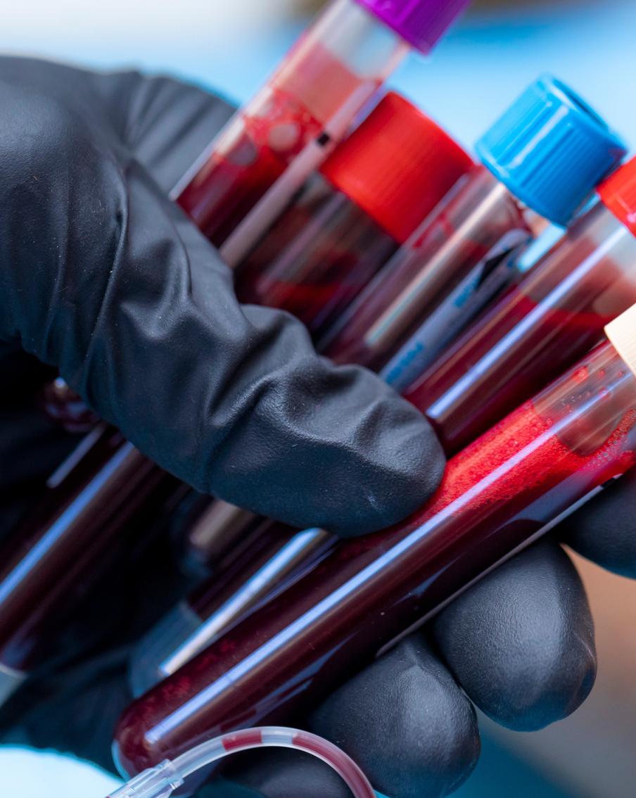 В США зафиксировали рост заболеваемости населения "плотоядной" бактерией Vibrio vulnificus