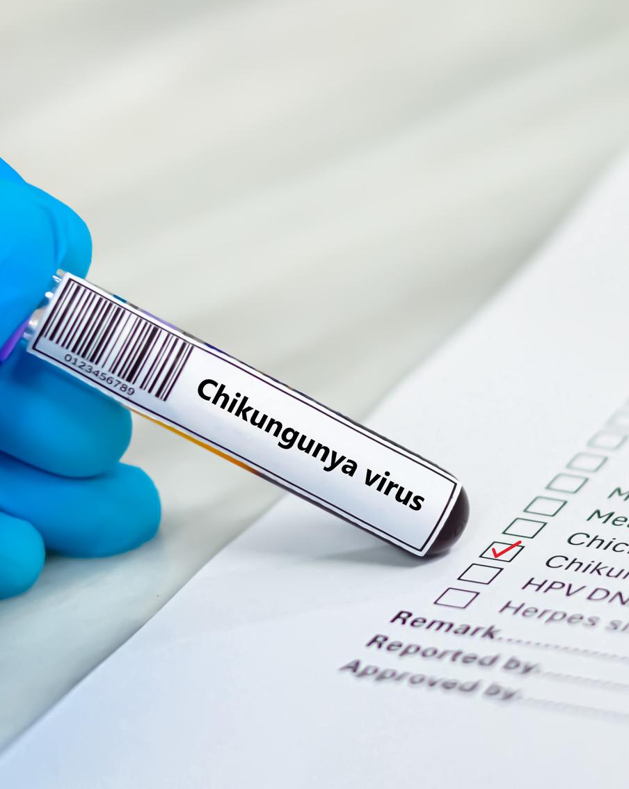 Чикунгунья в Китае: угрожает ли России новая эпидемия?