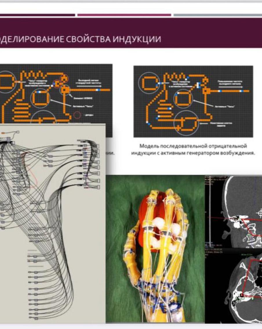 Нейросеть поможет создать экзопротез, работающий как родная рука