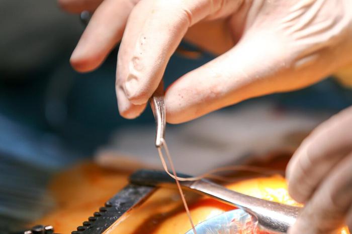 Китайцы пересадили лёгкое свиньи мертвецу – и вошли в историю