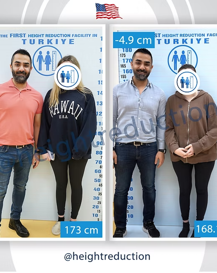 Зачем стамбульские девушки укорачивают ноги и опасно ли это