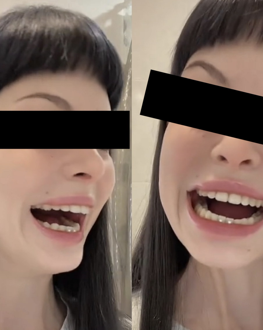 Почему улыбка Джокера захватила тиктокеров: блогеры массово подрезают уголки рта прямо у себя дома