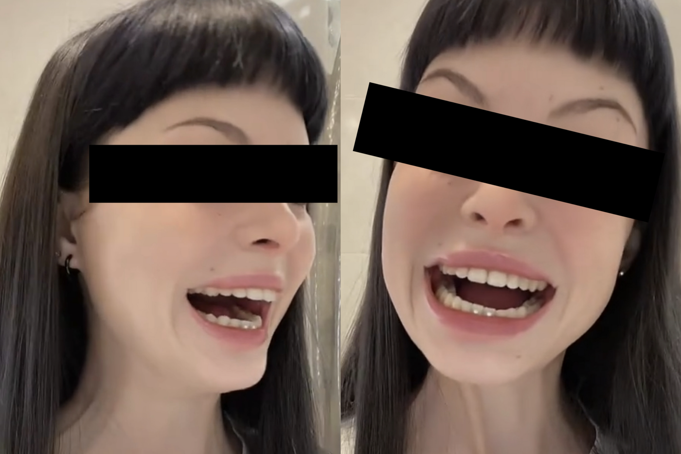 Улыбка Джокера своими руками: чем опасен новый тренд из TikTok
