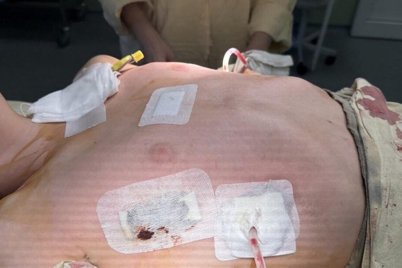 До, во время и после операции.